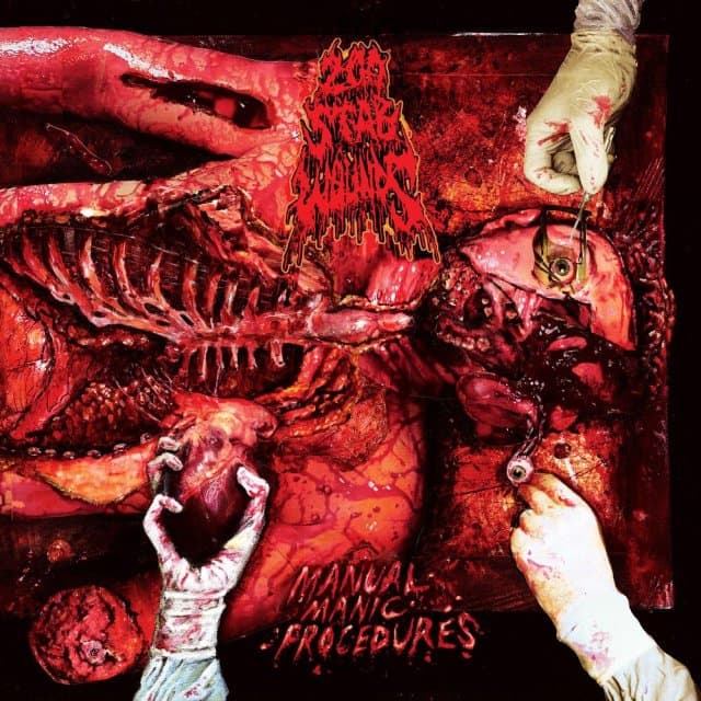 200 STAB WOUNDS - Manual Manic Procedures (plutonium Green / Yellow Marble Vinyl)